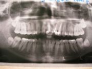 IMG 4596