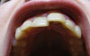 IMG 4811