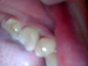 IMG 20151005 183356